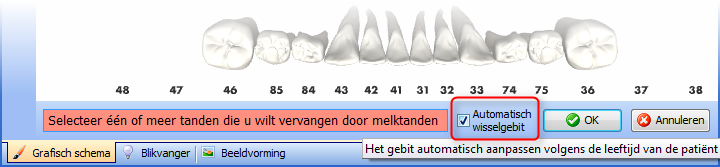 Automatisch wisselgebit bij wisselen tand